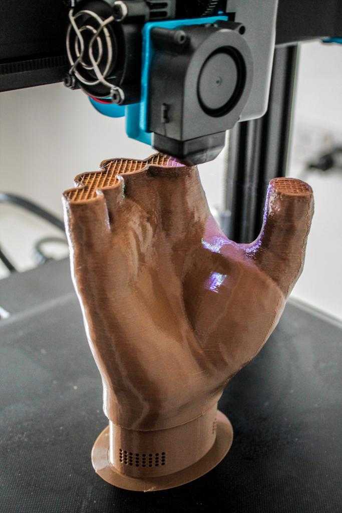 Customized prostheses